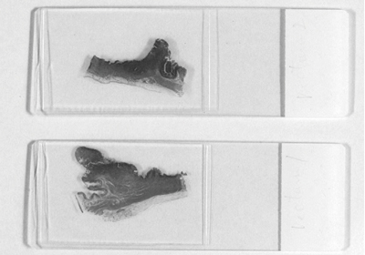 ミクロトーム作業