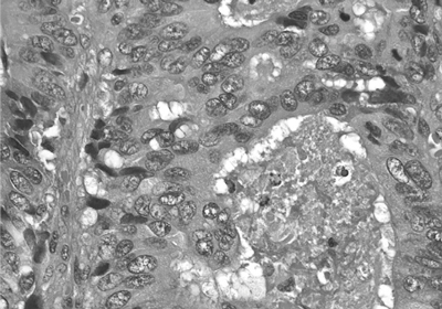 ミクロトーム作業